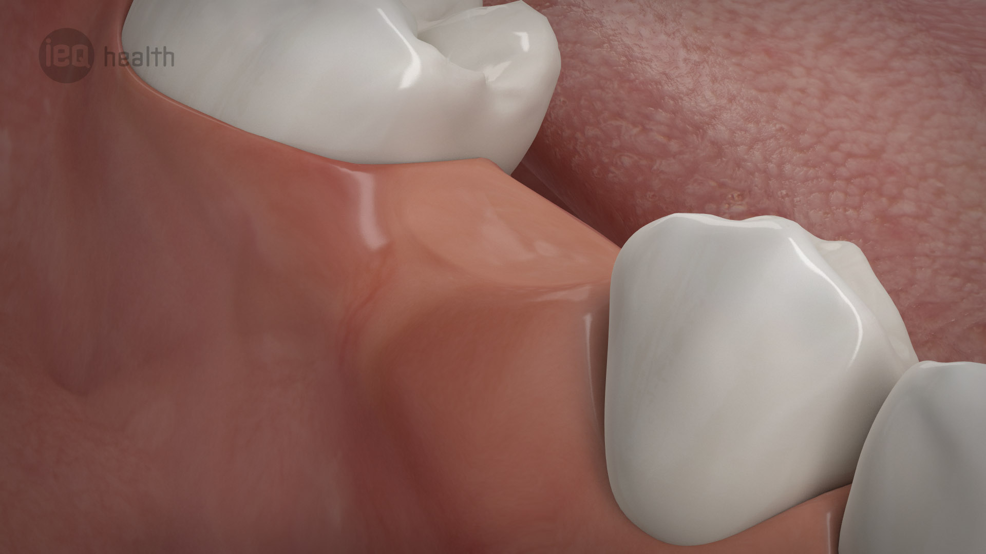 Knochenaufbau Rückbildung