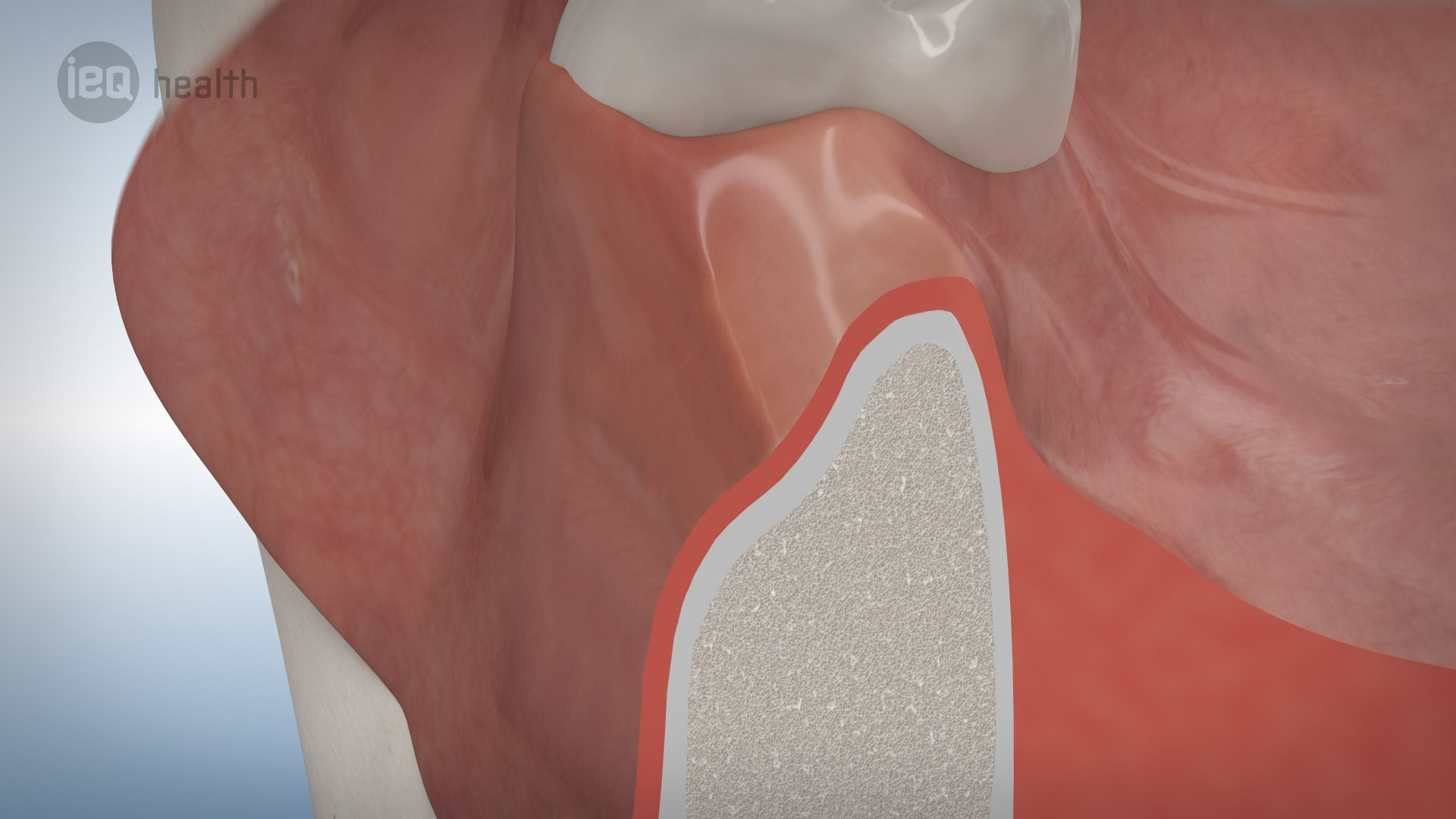 Knochenaufbau Rückbildung