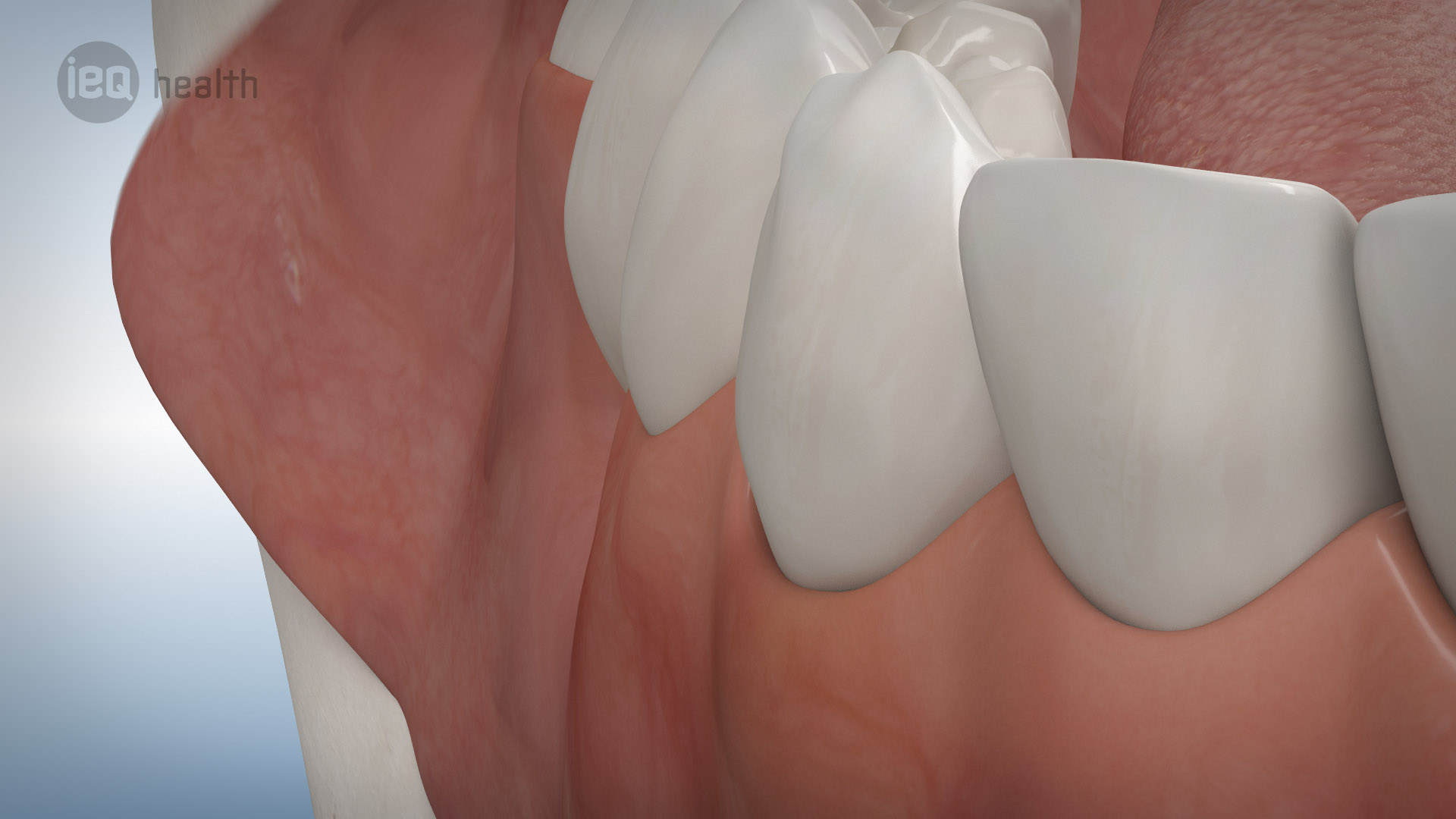 Knochenaufbau Rückbildung