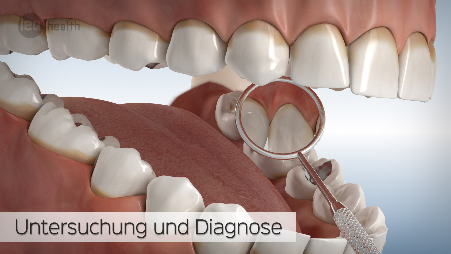 Professionelle Zahnreinigung