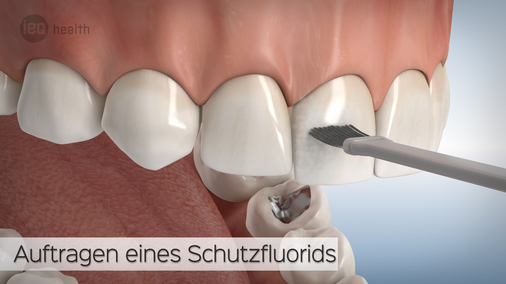 Professionelle Zahnreinigung